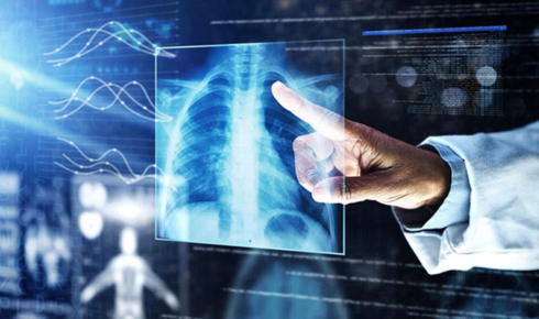 X-ray machine